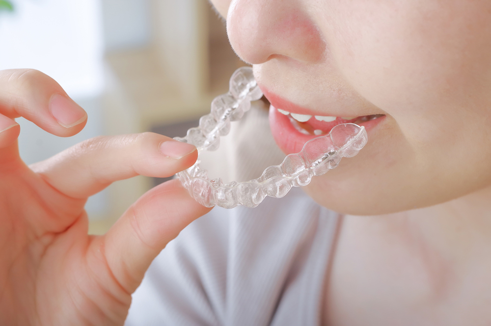 ライフスタイルに合わせて美しい歯に